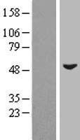 ZIC3 Protein - Western validation with an anti-DDK antibody * L: Control HEK293 lysate R: Over-expression lysate