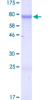 ZIC3 Protein - 12.5% SDS-PAGE of human ZIC3 stained with Coomassie Blue