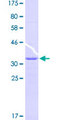 ZIC4 Protein - 12.5% SDS-PAGE Stained with Coomassie Blue.