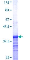 ZIC4 Protein - 12.5% SDS-PAGE Stained with Coomassie Blue.