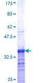 ZIC4 Protein - 12.5% SDS-PAGE Stained with Coomassie Blue.