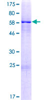 ZIK1 Protein - 12.5% SDS-PAGE of human ZIK1 stained with Coomassie Blue