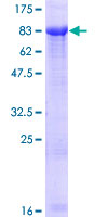 ZIM2 Protein - 12.5% SDS-PAGE of human ZIM2 stained with Coomassie Blue