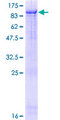 ZKSCAN1 / ZNF36 Protein - 12.5% SDS-PAGE of human ZKSCAN1 stained with Coomassie Blue