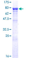 ZKSCAN3 / ZNF306 Protein - 12.5% SDS-PAGE of human ZKSCAN3 stained with Coomassie Blue