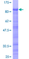 ZKSCAN3 / ZNF306 Protein - 12.5% SDS-PAGE of human ZNF306 stained with Coomassie Blue
