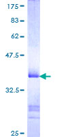 ZKSCAN3 / ZNF306 Protein - 12.5% SDS-PAGE Stained with Coomassie Blue.