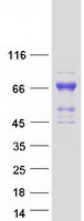 ZKSCAN3 / ZNF306 Protein - Purified recombinant protein ZKSCAN3 was analyzed by SDS-PAGE gel and Coomassie Blue Staining