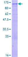 ZKSCAN5 Protein - 12.5% SDS-PAGE of human ZKSCAN5 stained with Coomassie Blue