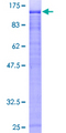 ZKSCAN5 Protein - 12.5% SDS-PAGE of human ZFP95 stained with Coomassie Blue