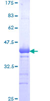 ZKSCAN5 Protein - 12.5% SDS-PAGE Stained with Coomassie Blue.