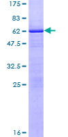 ZMAT3 Protein - 12.5% SDS-PAGE of human WIG1 stained with Coomassie Blue