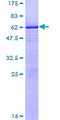 ZMAT3 Protein - 12.5% SDS-PAGE of human WIG1 stained with Coomassie Blue