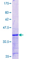 ZMAT3 Protein - 12.5% SDS-PAGE Stained with Coomassie Blue.