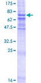 ZMPSTE24 Protein - 12.5% SDS-PAGE of human ZMPSTE24 stained with Coomassie Blue