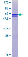 ZMYM2 / RAMP Protein - 12.5% SDS-PAGE Stained with Coomassie Blue.
