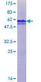 ZMYM2 / RAMP Protein - 12.5% SDS-PAGE Stained with Coomassie Blue.