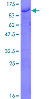ZMYM3 Protein - 12.5% SDS-PAGE of human ZMYM3 stained with Coomassie Blue