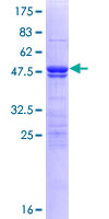 ZMYM5 Protein - 12.5% SDS-PAGE of human ZMYM5 stained with Coomassie Blue