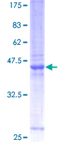 ZMYM6 Protein - 12.5% SDS-PAGE of human ZMYM6 stained with Coomassie Blue