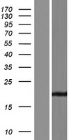 ZMYM6NB Protein - Western validation with an anti-DDK antibody * L: Control HEK293 lysate R: Over-expression lysate