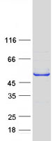 ZMYND10 Protein - Purified recombinant protein ZMYND10 was analyzed by SDS-PAGE gel and Coomassie Blue Staining