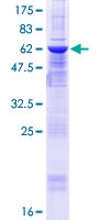 ZMYND12 Protein - 12.5% SDS-PAGE of human ZMYND12 stained with Coomassie Blue