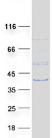 ZMYND12 Protein - Purified recombinant protein ZMYND12 was analyzed by SDS-PAGE gel and Coomassie Blue Staining