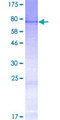 ZMYND17 Protein - 12.5% SDS-PAGE of human MSS51 stained with Coomassie Blue