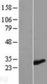 ZMYND19 Protein - Western validation with an anti-DDK antibody * L: Control HEK293 lysate R: Over-expression lysate