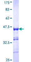 ZMYND8 / RACK7 Protein - 12.5% SDS-PAGE Stained with Coomassie Blue.