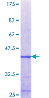ZNF10 / KOX1 Protein - 12.5% SDS-PAGE Stained with Coomassie Blue.