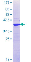 ZNF100 Protein - 12.5% SDS-PAGE Stained with Coomassie Blue.