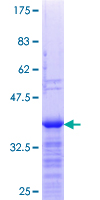 ZNF101 Protein - 12.5% SDS-PAGE Stained with Coomassie Blue.
