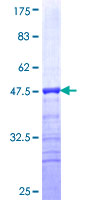 ZNF12 Protein - 12.5% SDS-PAGE Stained with Coomassie Blue.