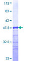 ZNF12 Protein - 12.5% SDS-PAGE Stained with Coomassie Blue.