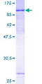 ZNF131 Protein - 12.5% SDS-PAGE of human ZNF131 stained with Coomassie Blue