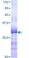 ZNF131 Protein - 12.5% SDS-PAGE Stained with Coomassie Blue.