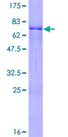 ZNF134 Protein - 12.5% SDS-PAGE of human ZNF134 stained with Coomassie Blue