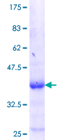 ZNF134 Protein - 12.5% SDS-PAGE Stained with Coomassie Blue.