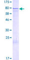 ZNF136 Protein - 12.5% SDS-PAGE of human ZNF136 stained with Coomassie Blue