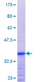 ZNF138 Protein - 12.5% SDS-PAGE Stained with Coomassie Blue.