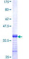 ZNF14 Protein - 12.5% SDS-PAGE Stained with Coomassie Blue.