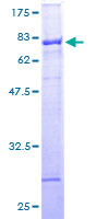 ZNF140 Protein - 12.5% SDS-PAGE of human ZNF140 stained with Coomassie Blue