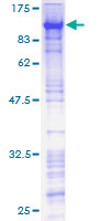 ZNF143 / STAF Protein - 12.5% SDS-PAGE of human ZNF143 stained with Coomassie Blue