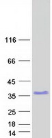 ZNF146 Protein - Purified recombinant protein ZNF146 was analyzed by SDS-PAGE gel and Coomassie Blue Staining
