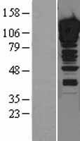 ZNF148 / ZBP-89 Protein - Western validation with an anti-DDK antibody * L: Control HEK293 lysate R: Over-expression lysate
