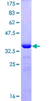 ZNF148 / ZBP-89 Protein - 12.5% SDS-PAGE Stained with Coomassie Blue.