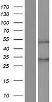 ZNF154 Protein - Western validation with an anti-DDK antibody * L: Control HEK293 lysate R: Over-expression lysate