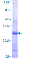 ZNF154 Protein - 12.5% SDS-PAGE Stained with Coomassie Blue.
